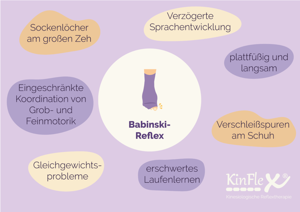 Babinski Reflex